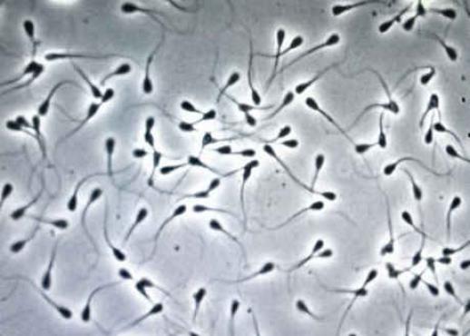 Semen in microscope view